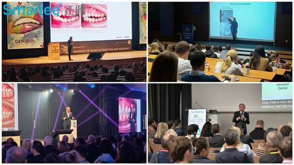 正雅GS颌位重建技术引领全球隐形正畸技术创新