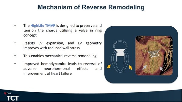沛嘉医疗授权合作伙伴HighLife SAS研发的HighLifeTSMVR系统斩获欧洲CE认证，引领二尖瓣反流介入治疗新范式