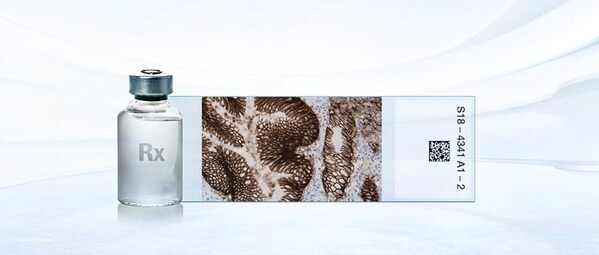 中国首个：威络益伴随诊断试剂(CLDN18) 获批