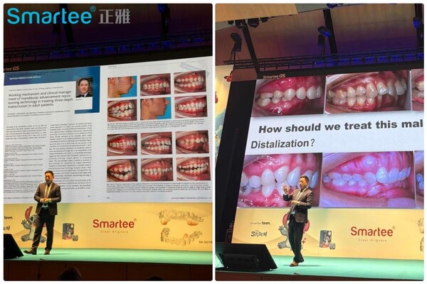 正雅亮相西班牙国际正畸大会：以"颌位重建"方案拓展严重骨性错He与OSA治疗边界