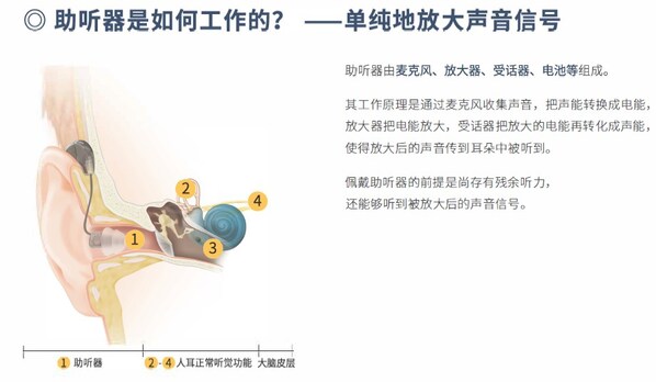 别让孩子在"声音的孤岛"默默长大:0-6岁听损儿童如何追上同龄人的"听觉"脚步 别让孩子在"声音的孤岛"默默长大:0-6岁听损儿童如何追上同龄人的"听觉"脚步