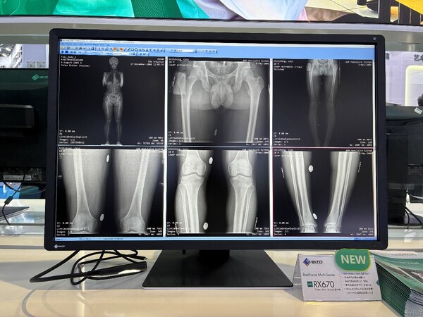 艺卓参展第93届CMEF  多款新品首度亮相