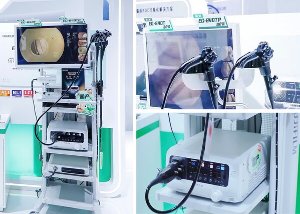 富士胶片推出新一代旗舰级内镜系统 中国制造助力消化道疾病诊疗发展 富士胶片推出新一代旗舰级内镜系统 中国制造助力消化道疾病诊疗发展